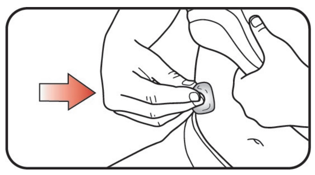 Mounjaro (tirzepatide) Injection - Step 14 Mounjaro (tirzepatide) Injection - Step 14