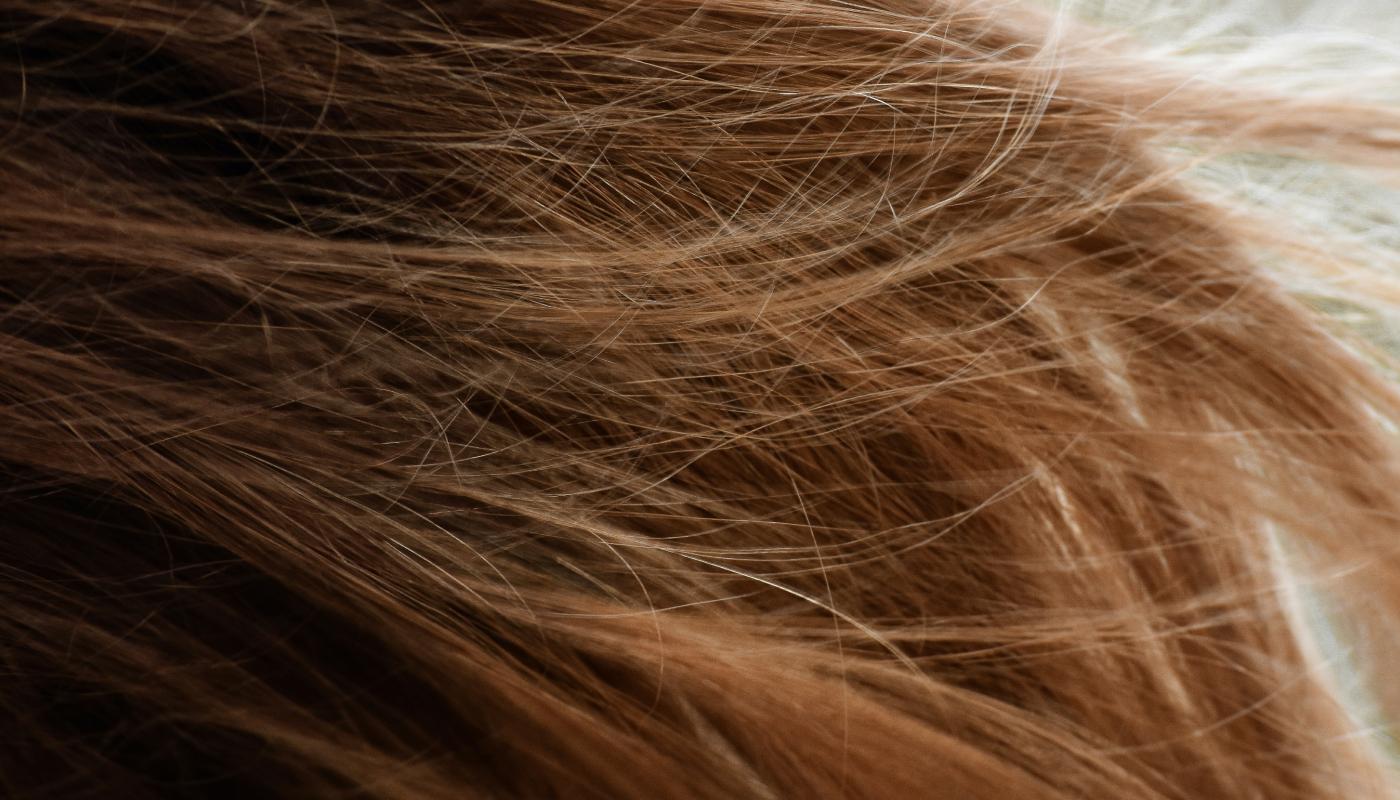 Lose Weight, Not Your Locks: Understanding and Treating Hair Loss After Weight Loss Medication Lose Weight, Not Your Locks: Understanding and Treating Hair Loss After Weight Loss Medication